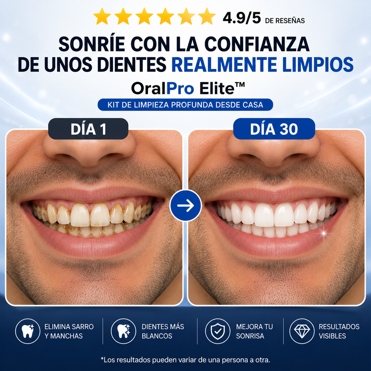 OralPro Elite™ | Kit de limpieza dental desde casa